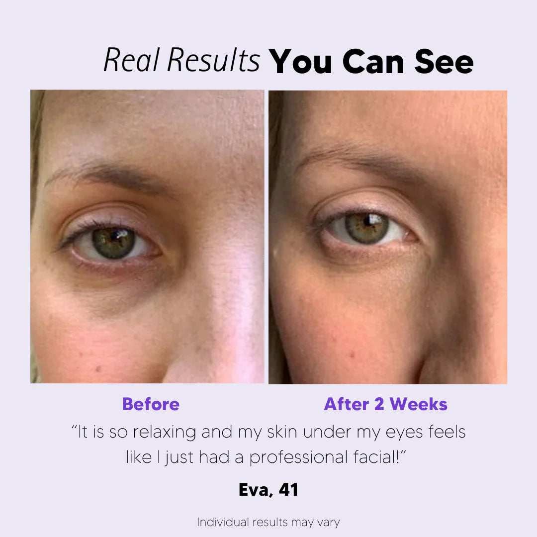 EyeBeauty Glasses